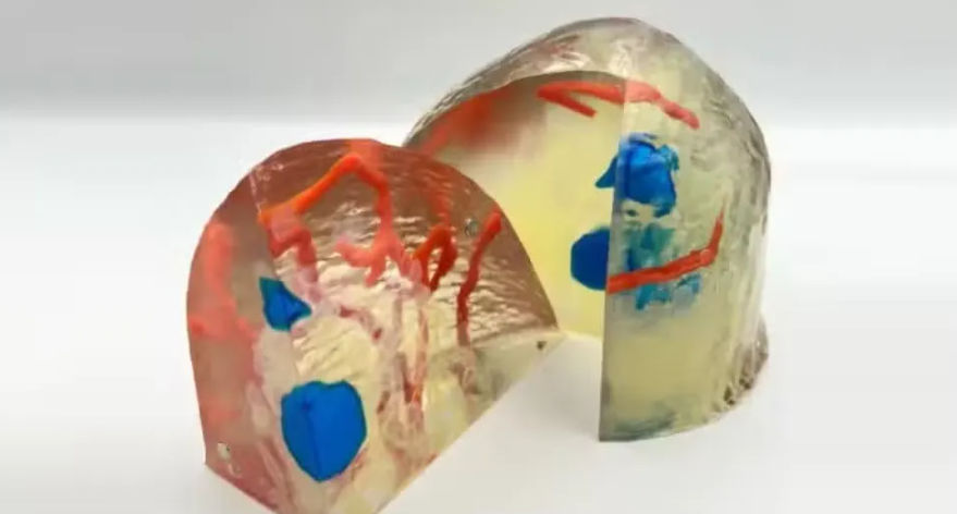 外科醫(yī)生利用3D 打印心臟模型治療心血管異常 image